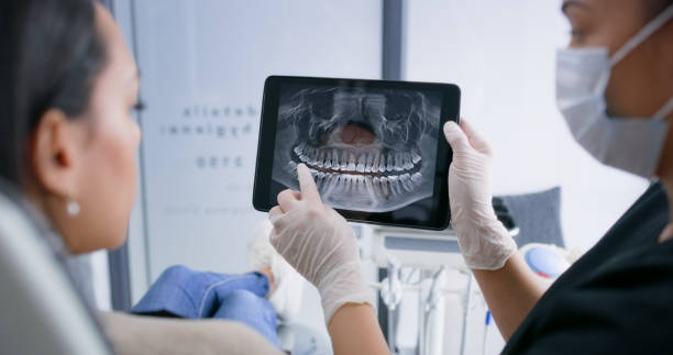 Licensed Dental Implants service in Burns Harbor, IN - Smile Center Dentistry